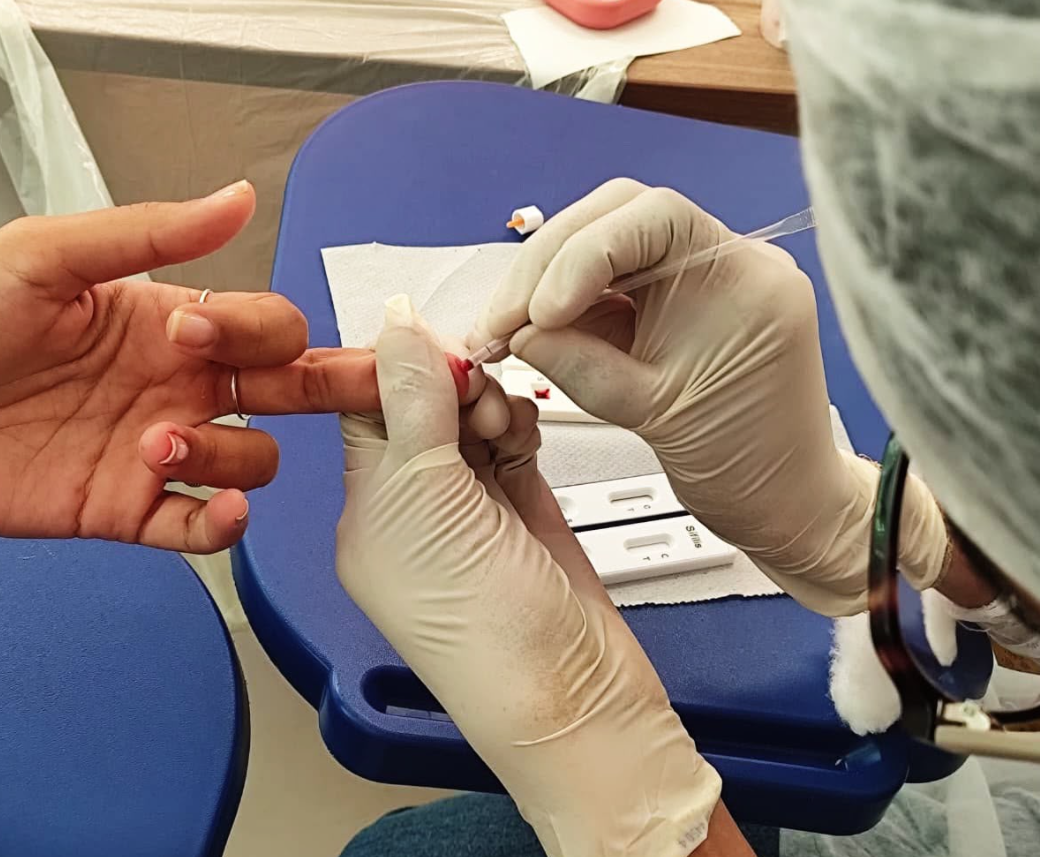 Palmas registra 24 notificações de hepatites virais no primeiro semestre de 2026
